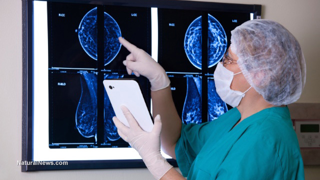 Ct Scans Increase Your Risk Of Cancer By 35 Percent