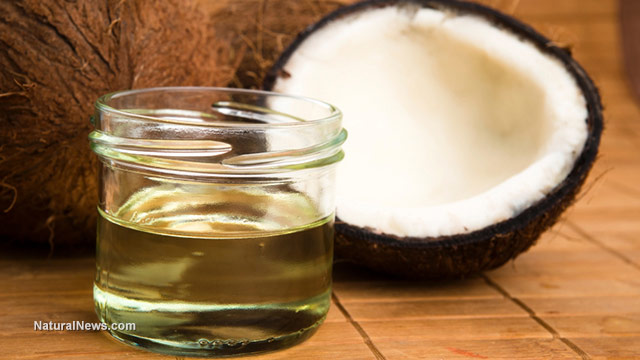 Image: 10 Things You Can Do With Coconut Oil