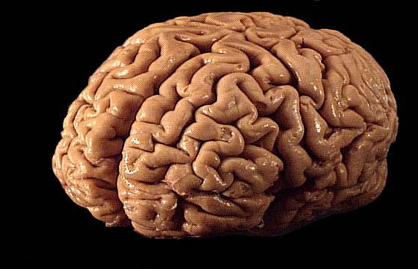 Image: Scientists are growing hundreds of human brains for testing