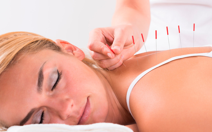 Image: Study finds acupuncture to be more effective in treating pain than morphine