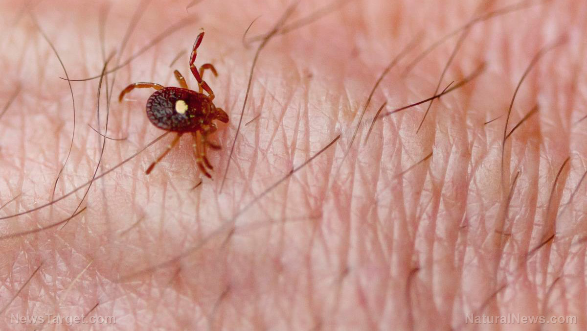 Image: Is 2017 the year of the Tick? Scientists predict a surge in Lyme disease cases