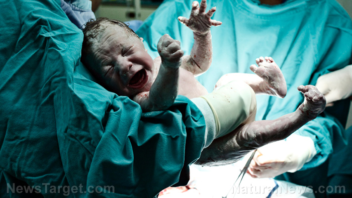Image: Doctor sued for “circumcision assault” of infant… genital mutilation happens to boys, too