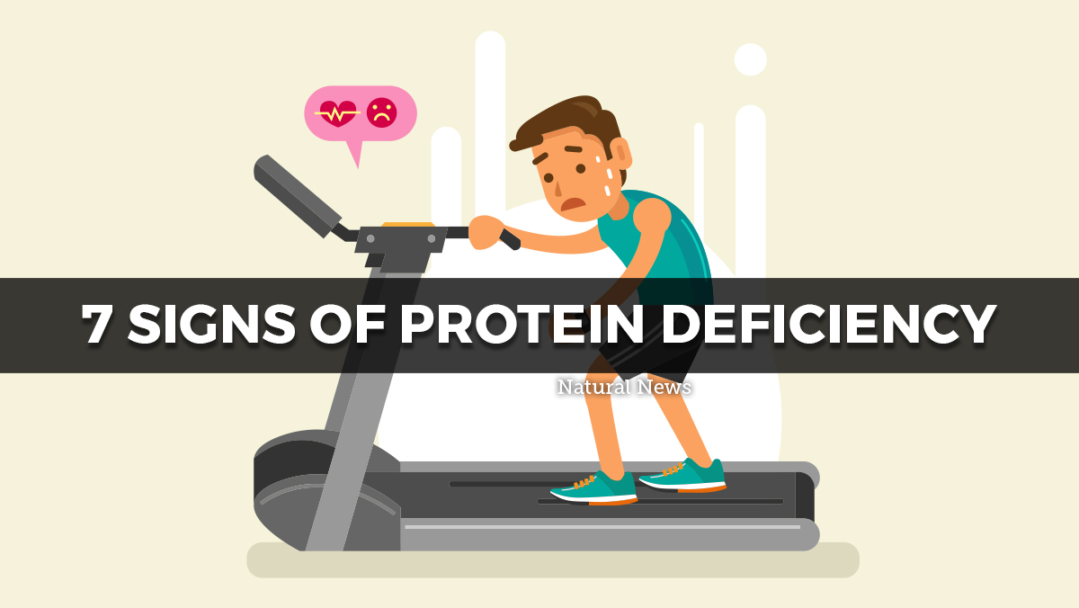 7 Signs Of Protein Deficiency 6920