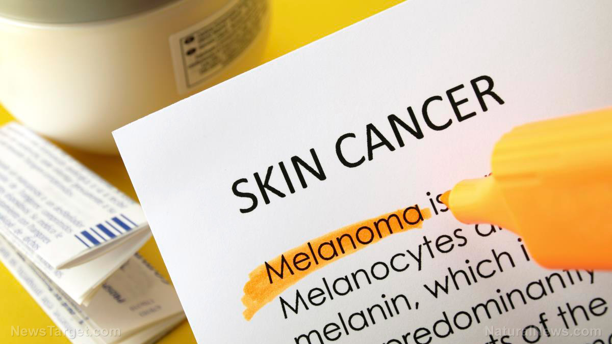 Image: Niacin (vitamin B3) can prevent melanoma, scientists confirm