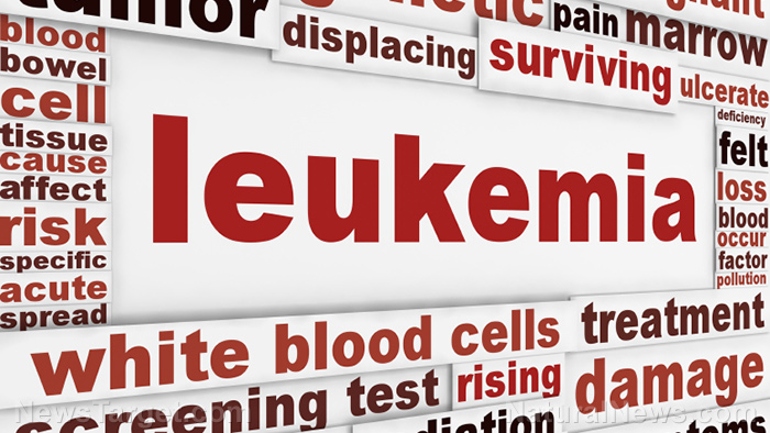 Image: Cannabis phytochemicals found to be effective in destroying leukemia cells