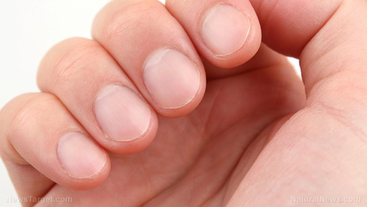 Image: 7 Things that can happen if you keep biting your nails