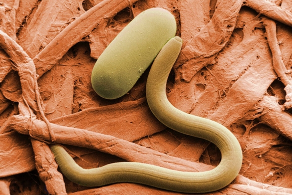 Image: Understanding internal parasites, and how to get rid of them naturally