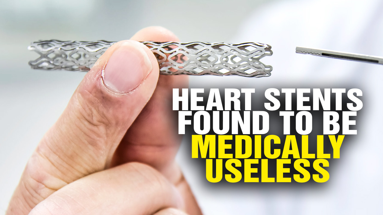 Image: Heart stent FAIL: Shocking study shows heart stents are medically useless