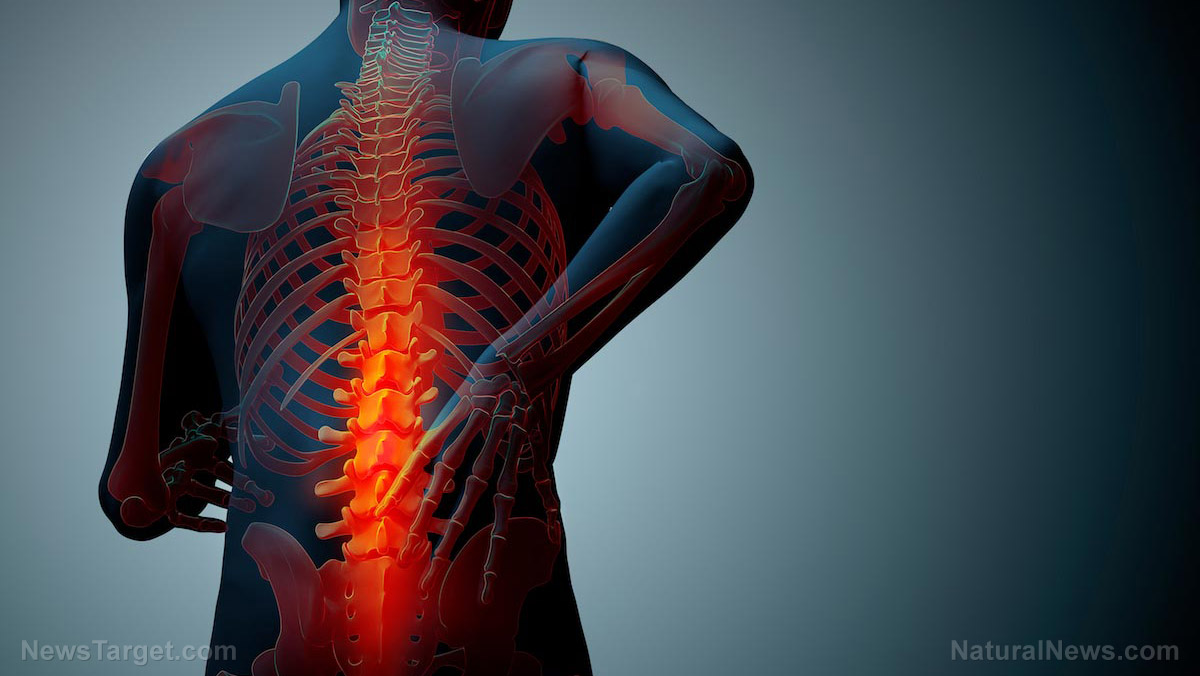 Image: Electrostimulation device found to drastically reduce back pain in 50% of patients; may avoid the risks of back surgery