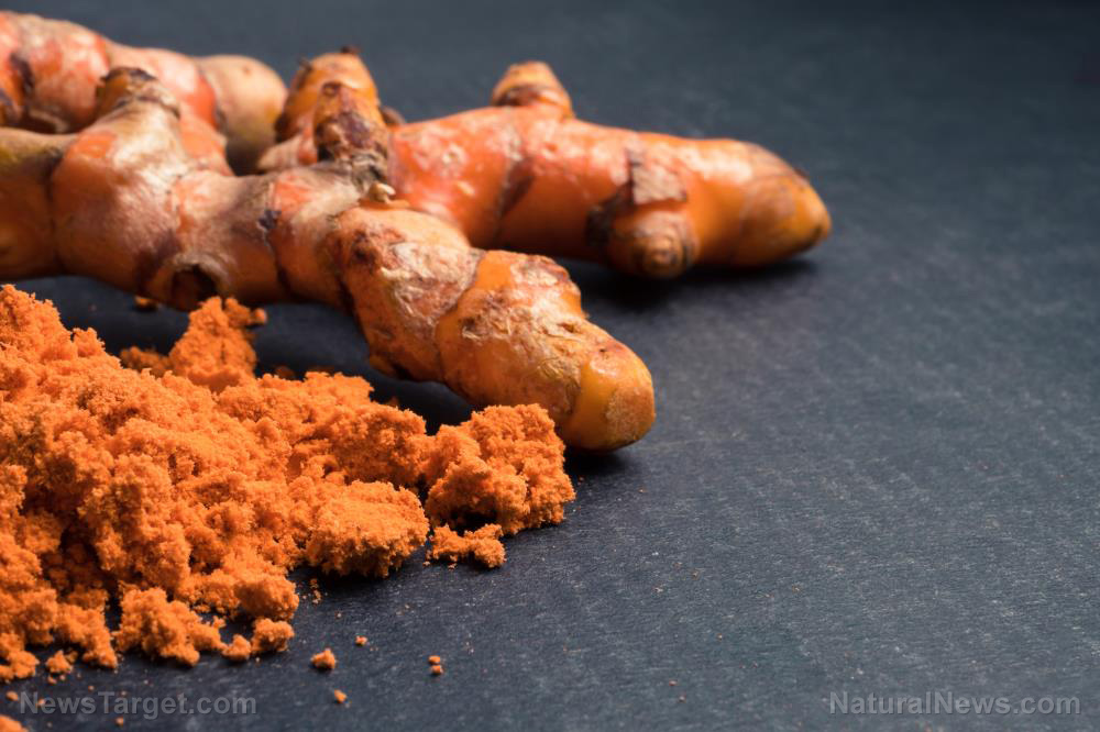 Image: It’s easier than you think — A basic guide to growing your own turmeric at home