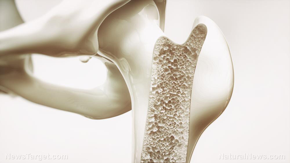 Image: Scientists develop a new biomaterial made from citrate to help hasten bone regeneration