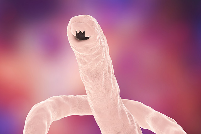 Image: Unwanted hitchhikers: Canadian couple brought home hookworms from the beach