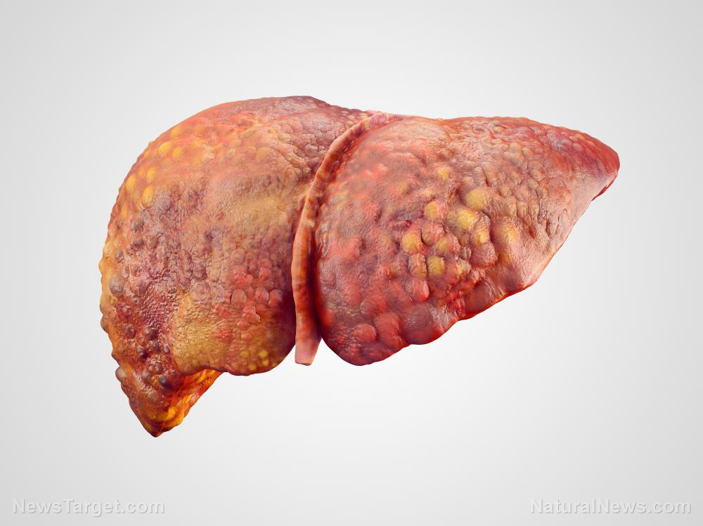 Image: Study concludes that the giant-leaved fig reduces oxidative stress in the liver