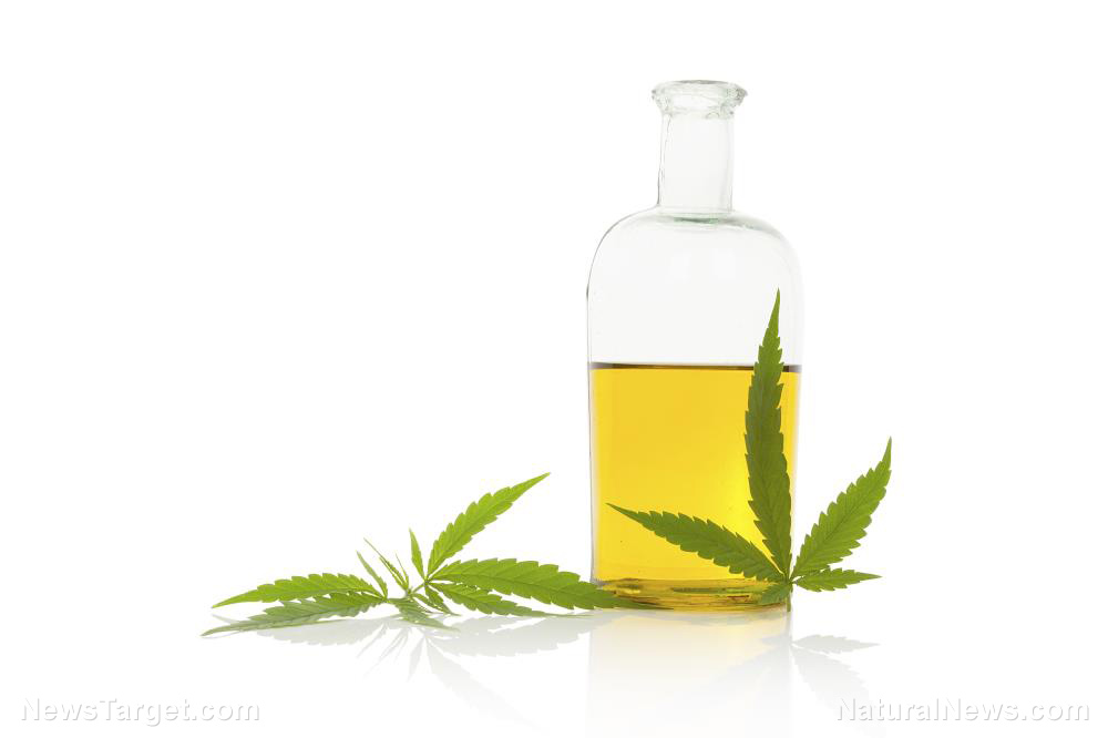 Image: Topical uses for marijuana: Study finds it effective at soothing skin problems such as eczema, psoriasis