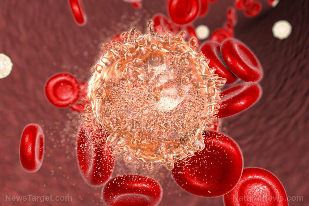 Image: Sophoraflavanone G found to induce cell death of human leukemia cells