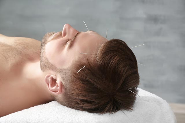Image: Autism symptoms may be reduced by therapeutic scalp acupuncture, researchers find