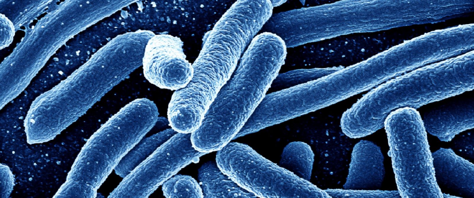 Image: Bacteria may travel around the world using “air bridges,” explaining how superbugs share genes