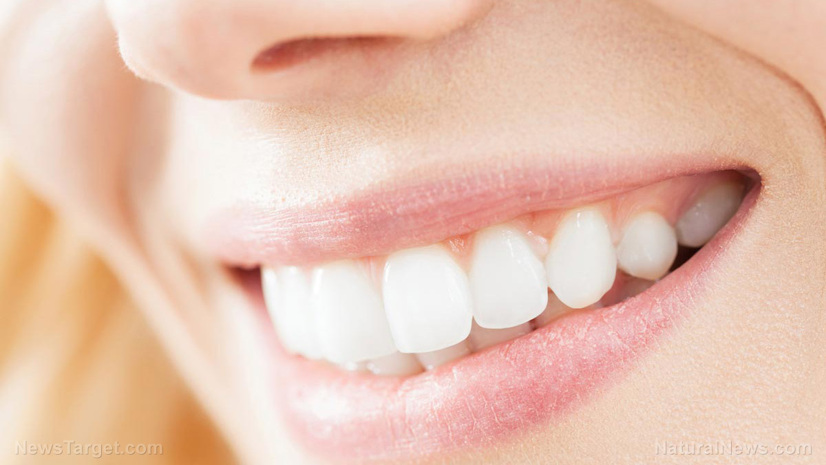Image: Teeth whitening does more harm than good – it can rot your teeth, study finds