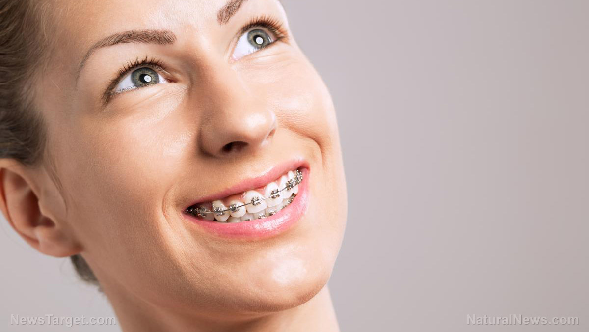 Image: The risk of braces: Study finds dental correction doesn’t always yield the expected confidence boost … Are the benefits worth the health risks?