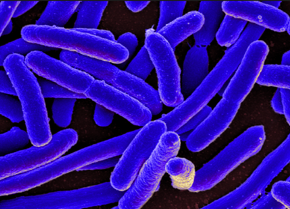 Image: Researchers investigate the antibacterial activity of Albizia adianthifolia