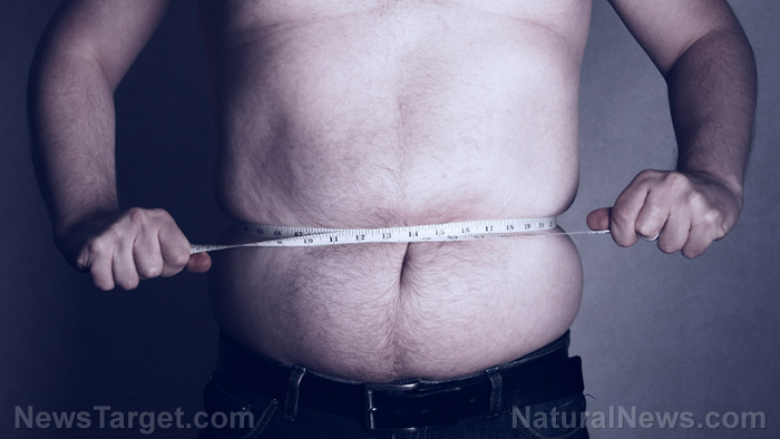 Image: Study shows obesity is the biggest chronic factor behind NYC coronavirus hospitalizations