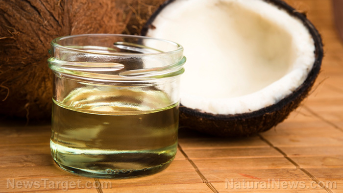 Image: Researchers study coconut oil as a natural treatment for antibiotic-resistant bacterial infections, severe burns