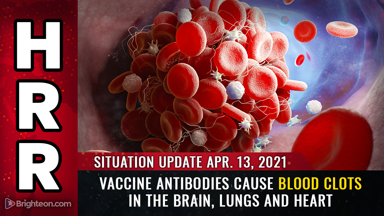 Image: April 13th: Vaccine antibodies CAUSE blood clots in the brain, lungs and heart… FDA calls halt to J&J vaccine as deaths accelerate