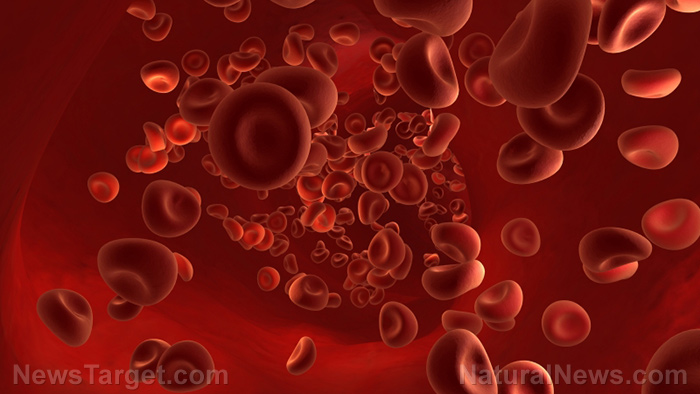 Image: Israeli study links Pfizer vaccine to deadly blood disease that causes blood clots