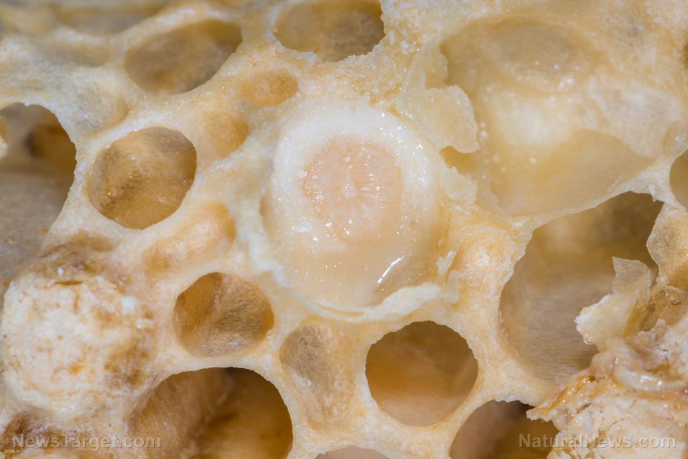 Image: Royal jelly supplementation found to alleviate menopausal symptoms