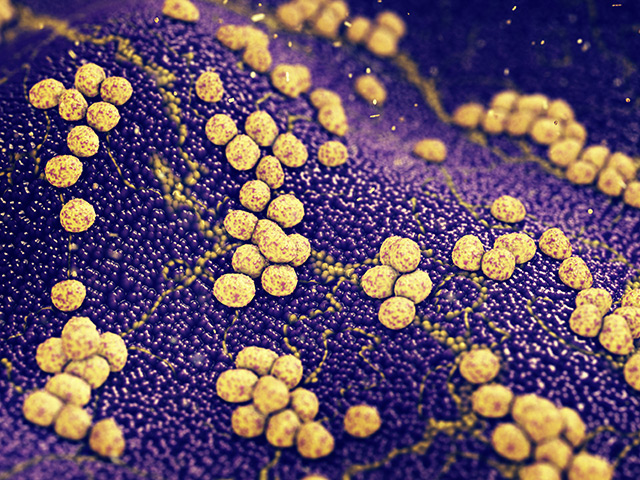 Image: Investigating the antimicrobial activity of berberine against Staphylococcus aureus