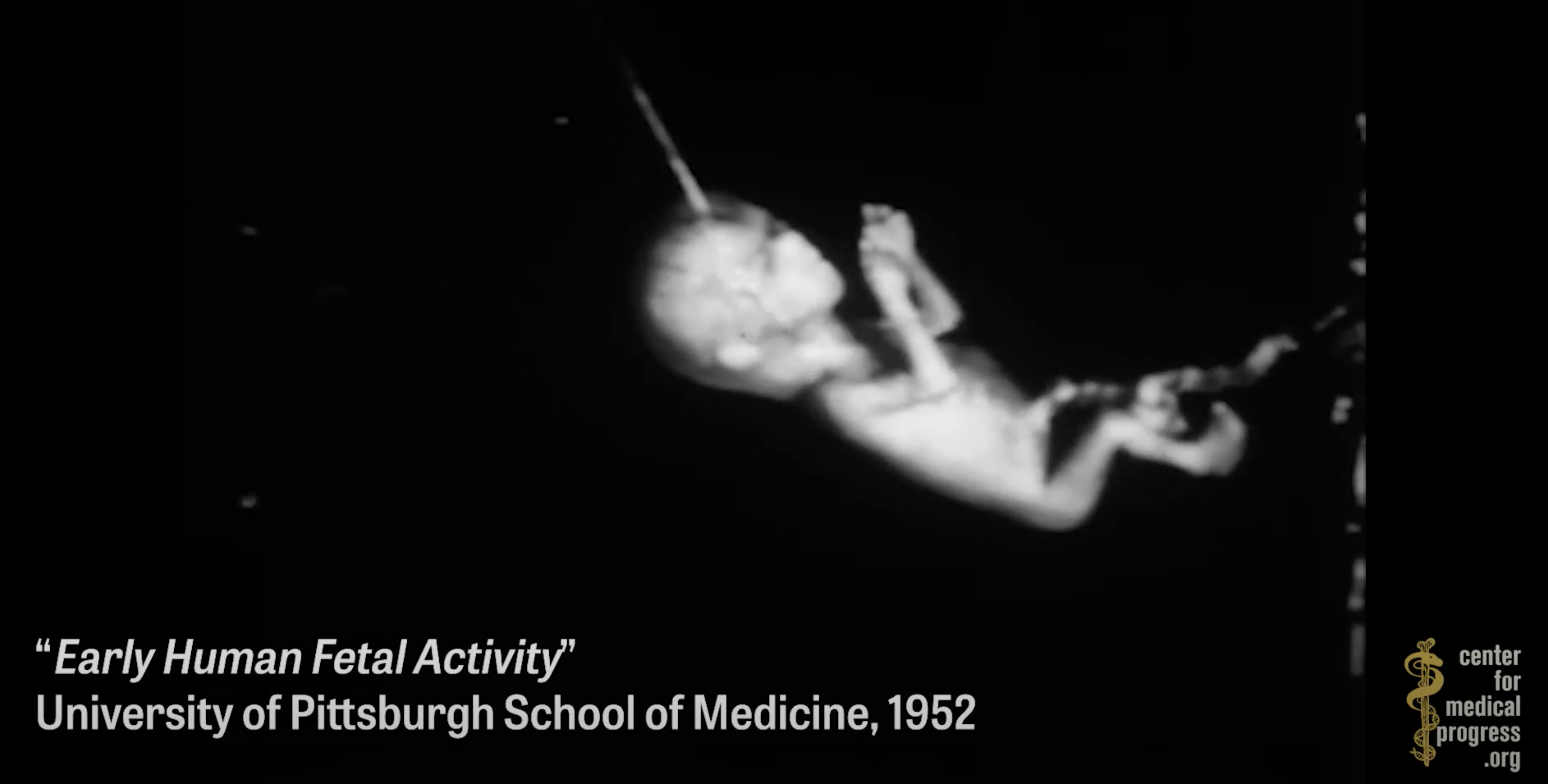 Image: University of Pittsburgh engaged in “Nazi-level” experimentation on aborted babies