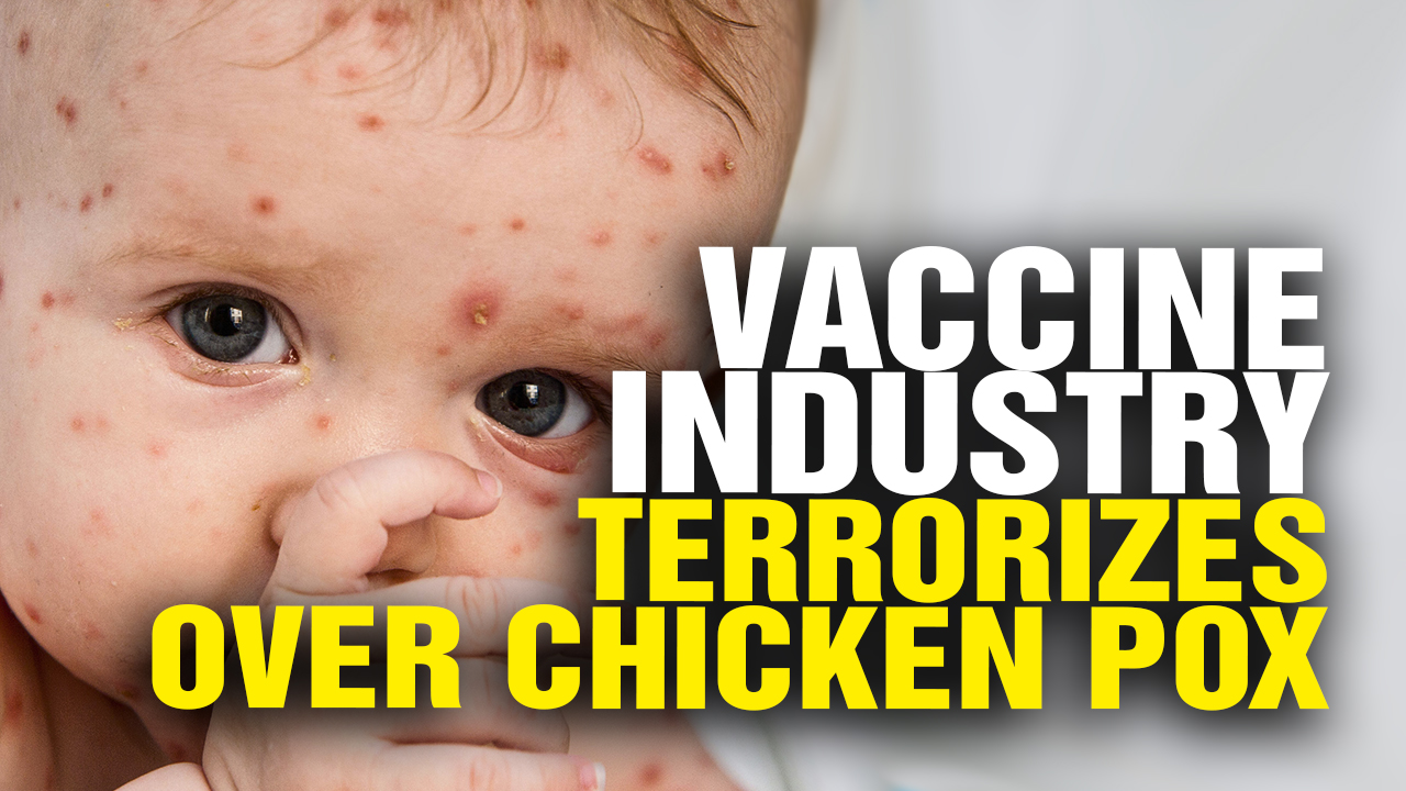 Image: Why not test everybody via PCR for chicken pox and lock down the whole world from a single case of chicken pox?