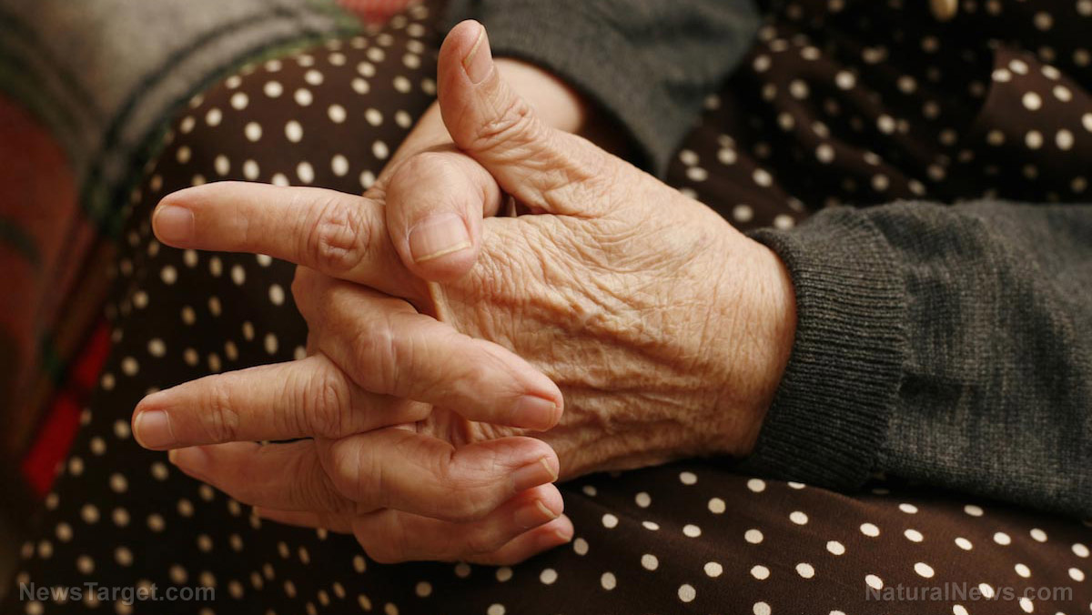 Image: 10 Proven ways to relieve rheumatoid arthritis naturally