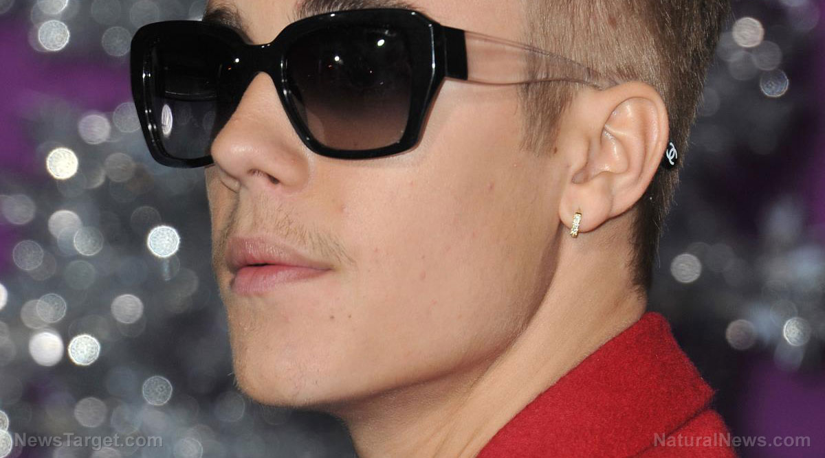 Image: Justin Bieber’s face paralyzed with Ramsay Hunt syndrome, a known adverse reaction of covid injections