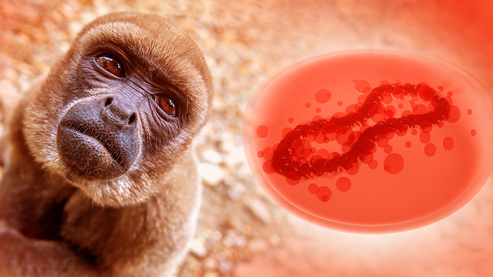 Image: WHO investigating reports of monkeypox virus in semen