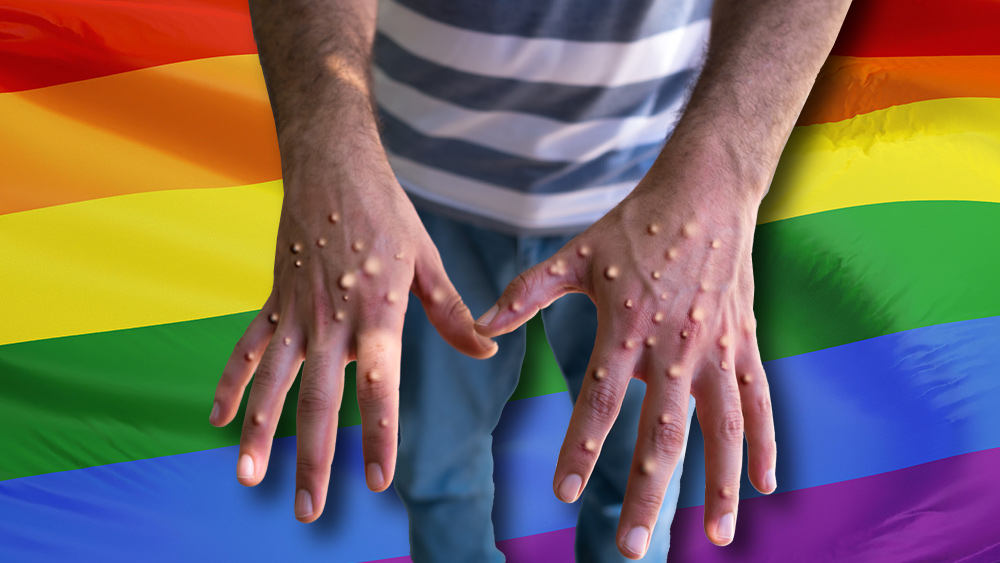Image: WHO finally tells LGBT males to stop their sex-capades to halt spread of monkeypox