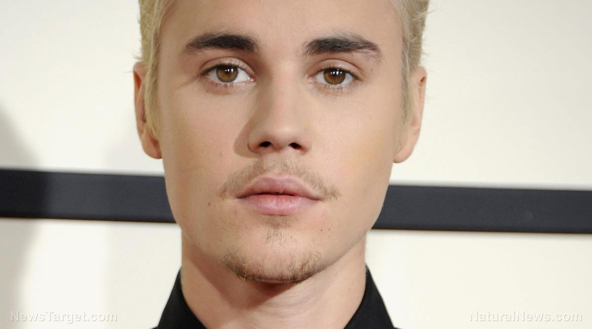 Image: Justin Bieber: Facial paralysis is ‘punishment’ for exposing illuminati pedophilia