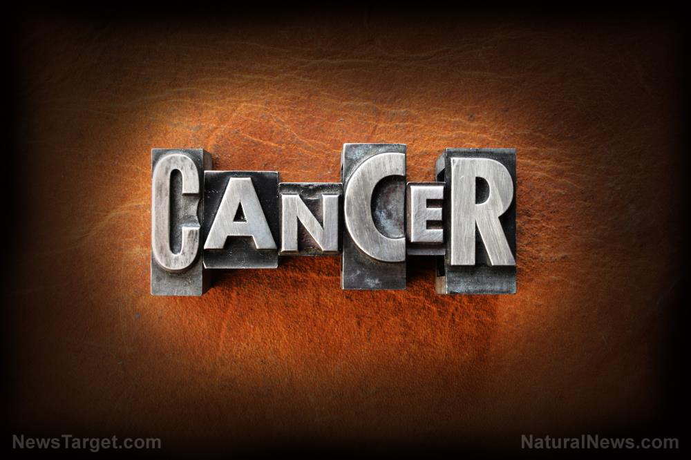 &#8220;Cancer Decoded&#8221; on BrightU: Turbo cancers, COVID vaccines and the role of environmental toxins in cancer cell formation