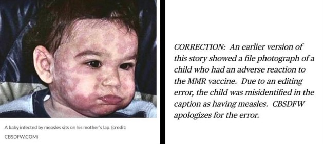 Pharma and Fake News mislabel death of child in Texas as “due to measles,” when it was the MMR VACCINE that DIRECTLY CAUSED his DEATH