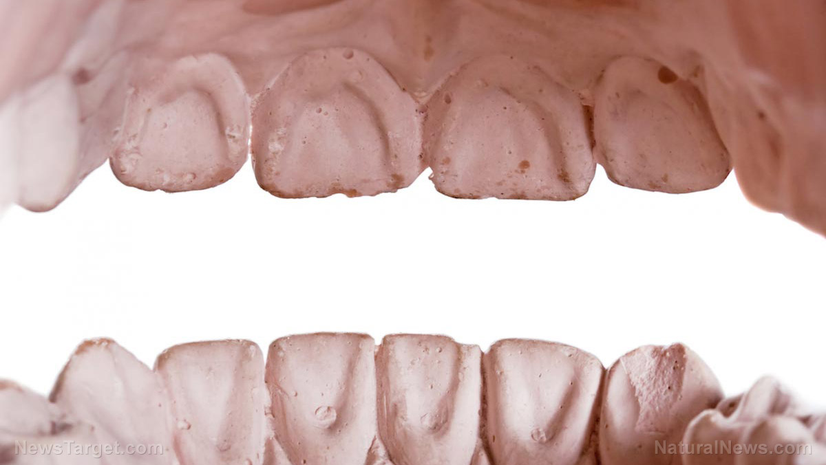 Sugar starts corroding your teeth in seconds but these holistic habits can mitigate the damage