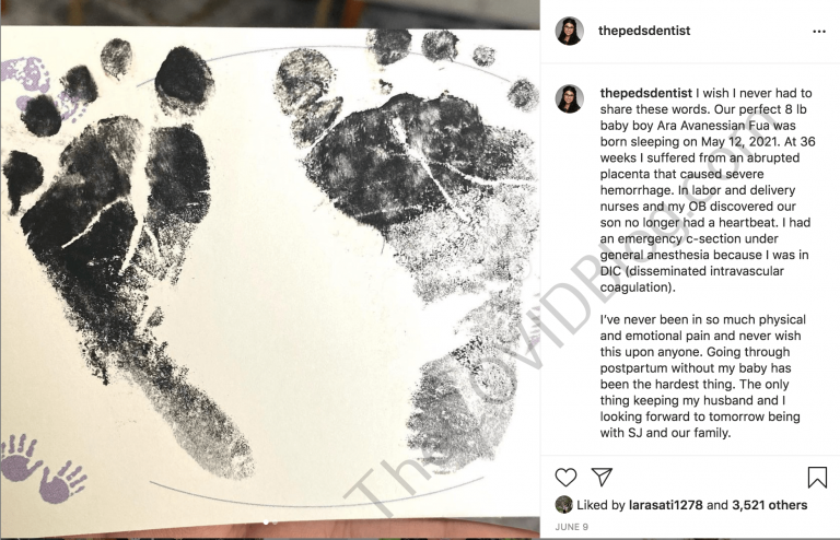 U.S. stillbirth rate declines slightly but racial disparities and systemic gaps persist