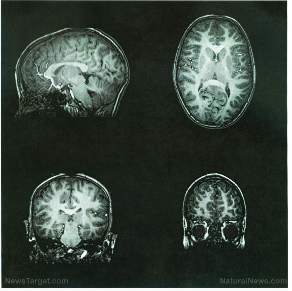 Rare childhood brain cancer cluster in Eastern Kentucky stumps health officials
