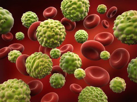 “Beyond The Diagnosis” on BrightU: Why your body runs out of fuel to fight cancer